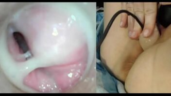 Bolita en la vagina