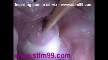 Quiropráctico vagina