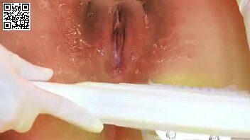 Depilacion de vulva